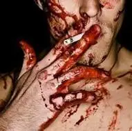 इग्नाटियस